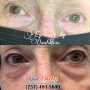 Eyelash extensions 23451 | Permanent Makeup by Oanh Khau @NailsOnly | Virginia Beach, VA 23451